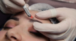 Soin du visage à Chamalières près de Clermont-Ferrand